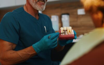 7 Benefits of Choosing Dental Implants for Missing Teeth